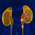 Kidney stones anatomy pain male internal organ painful cristalin
